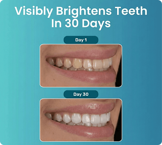 Visibly Brightens Teeth In 30 Days - Before and After Results
